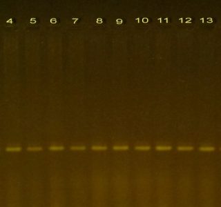 PCR product for PTEN gene for DNA samples of colorectal disease on 1.2 % agarose gel. Molecular marker (1) and (2-18) samples.